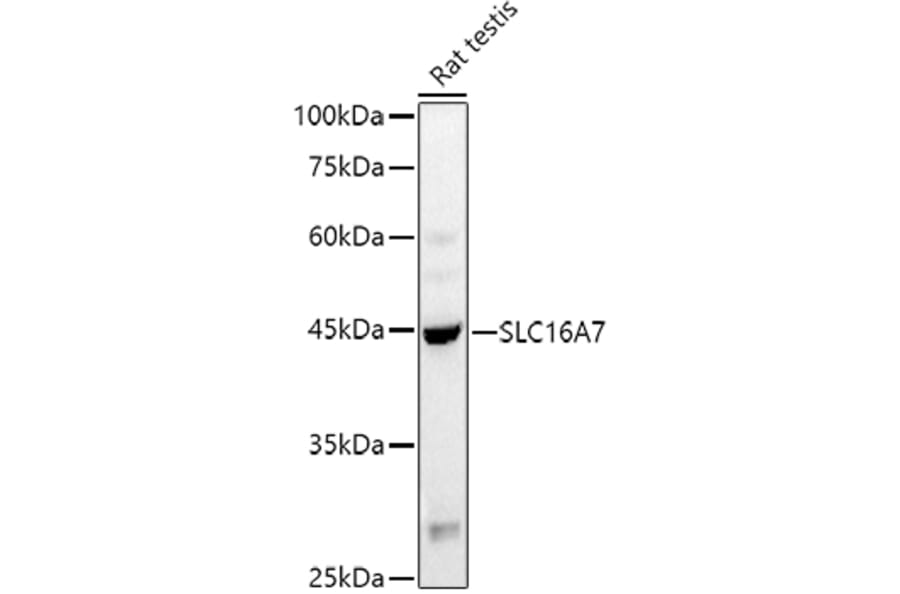 Western Blot - Anti-MCT2 Antibody (A80652) - Antibodies.com