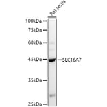 Western Blot - Anti-MCT2 Antibody (A80652) - Antibodies.com