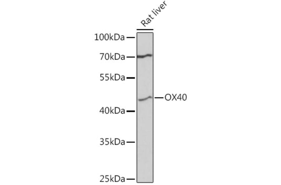 Western Blot - Anti-CD134/OX40L receptor Antibody (A80653) - Antibodies.com