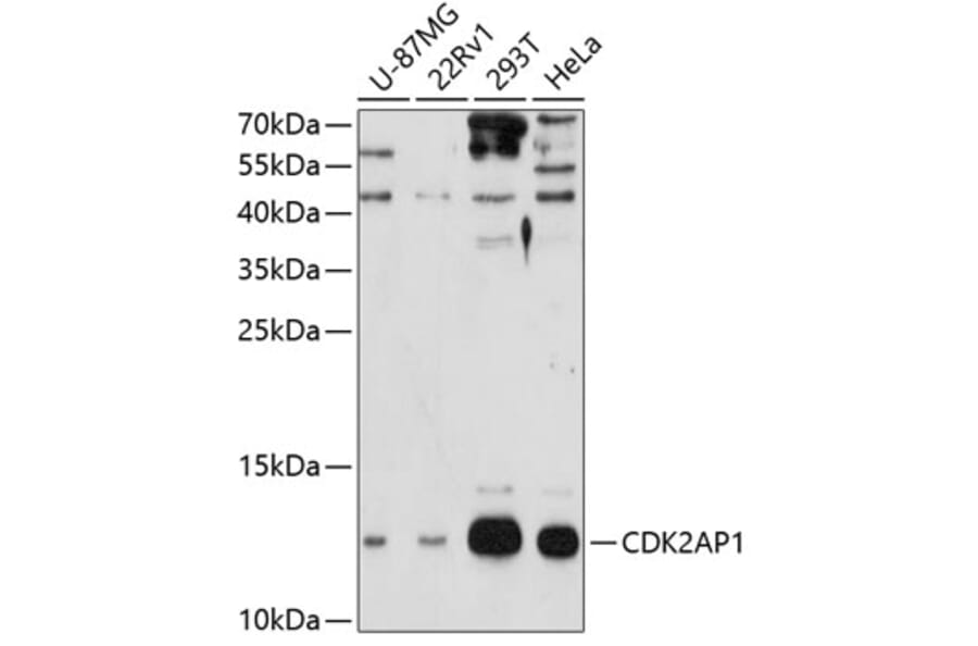 Western Blot - Anti-CDK2AP1 Antibody (A4203) - Antibodies.com