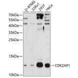 Western Blot - Anti-CDK2AP1 Antibody (A4203) - Antibodies.com