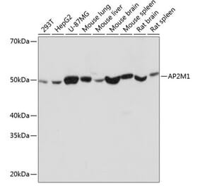 Western Blot - Anti-AP2M1 Antibody [ARC0522] (A80656) - Antibodies.com
