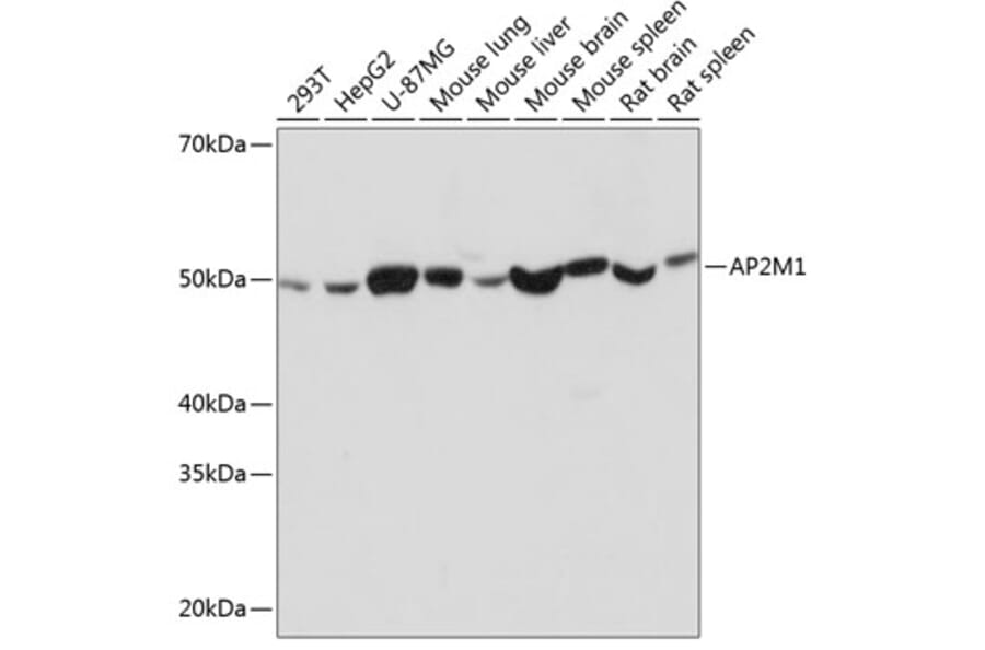 Western Blot - Anti-AP2M1 Antibody [ARC0522] (A80656) - Antibodies.com