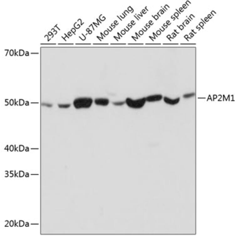 Western Blot - Anti-AP2M1 Antibody [ARC0522] (A80656) - Antibodies.com