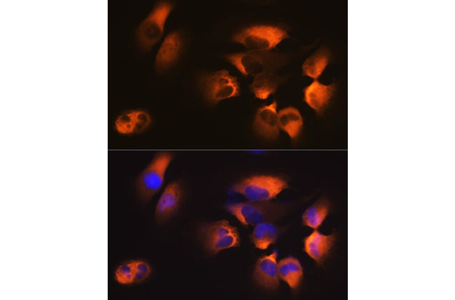 Immunofluorescence - Anti-AP2M1 Antibody [ARC0522] (A80656) - Antibodies.com