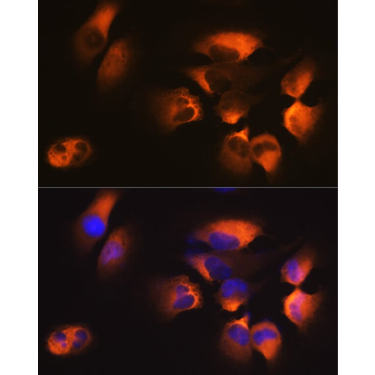 Immunofluorescence - Anti-AP2M1 Antibody [ARC0522] (A80656) - Antibodies.com