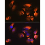 Immunofluorescence - Anti-AP2M1 Antibody [ARC0522] (A80656) - Antibodies.com