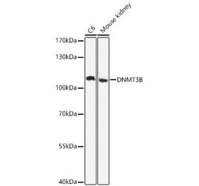 Western Blot - Anti-DNMT3B Antibody (A80657) - Antibodies.com