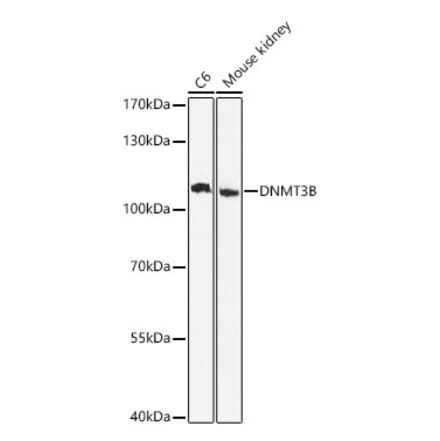 Western Blot - Anti-DNMT3B Antibody (A80657) - Antibodies.com