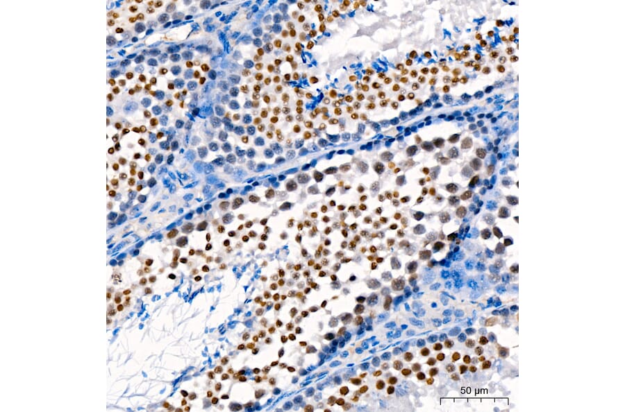 Immunohistochemistry - Anti-DNMT3B Antibody (A80657) - Antibodies.com