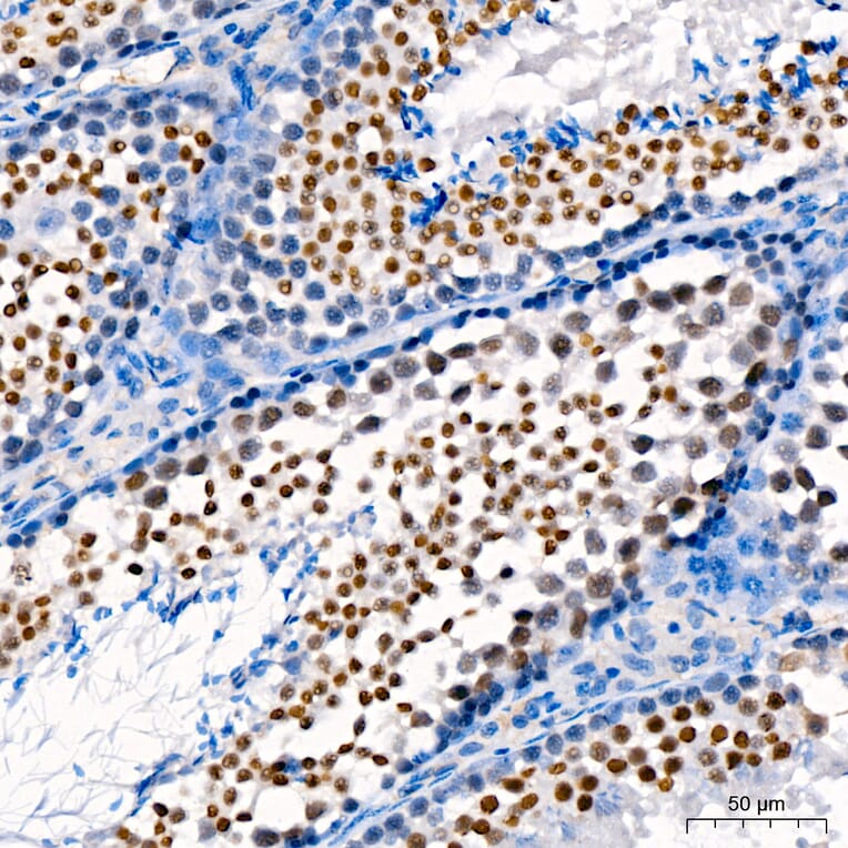 Immunohistochemistry - Anti-DNMT3B Antibody (A80657) - Antibodies.com