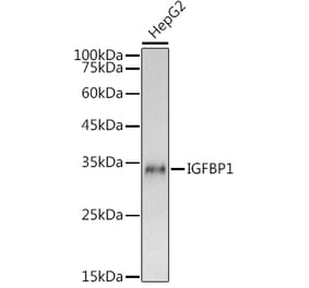 Western Blot - Anti-IGFBP1 Antibody (A80658) - Antibodies.com