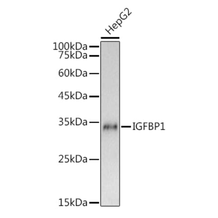 Western Blot - Anti-IGFBP1 Antibody (A80658) - Antibodies.com