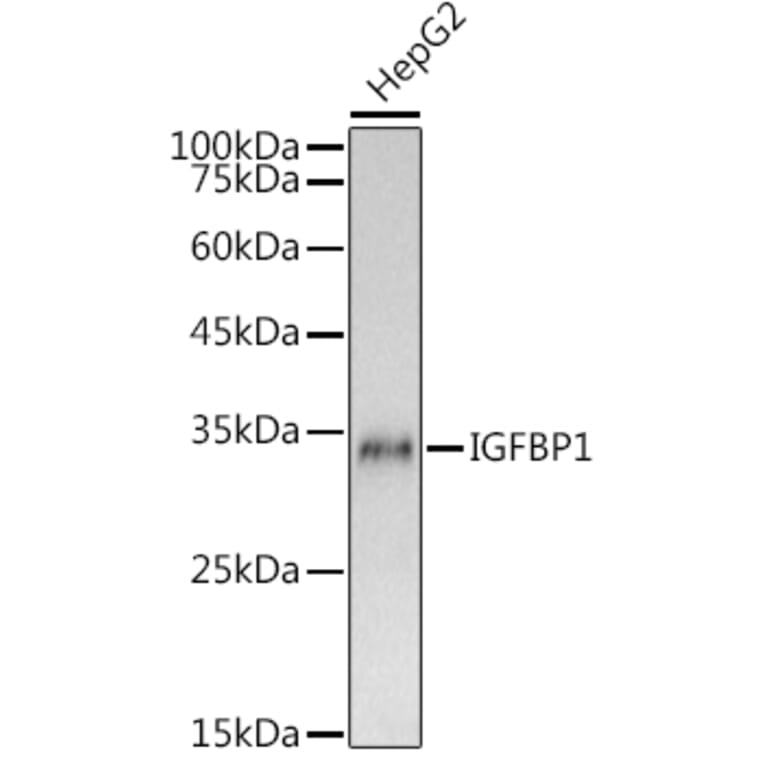 Western Blot - Anti-IGFBP1 Antibody (A80658) - Antibodies.com