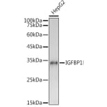 Western Blot - Anti-IGFBP1 Antibody (A80658) - Antibodies.com