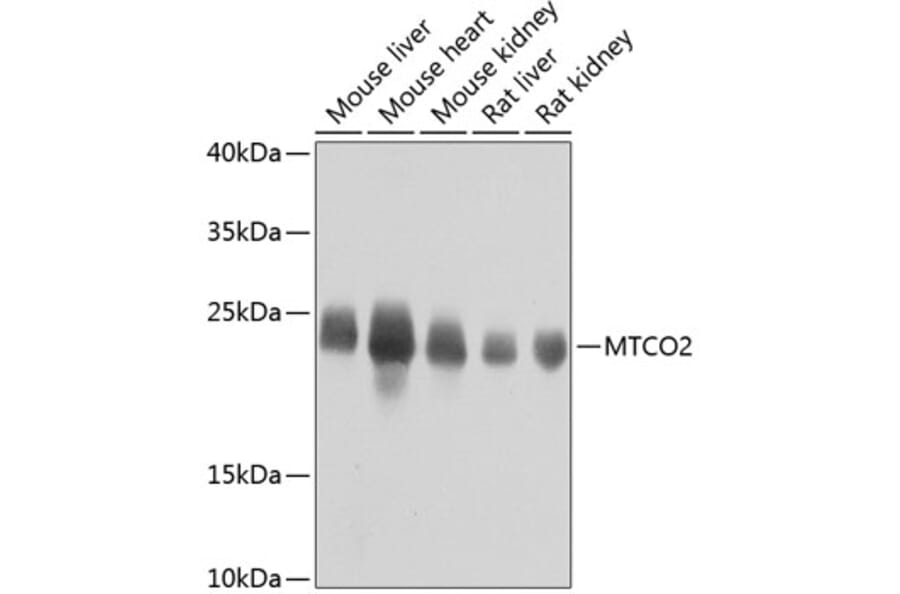 Western Blot - Anti-MTCO2 Antibody (A80659) - Antibodies.com