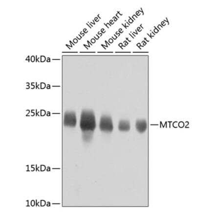 Western Blot - Anti-MTCO2 Antibody (A80659) - Antibodies.com