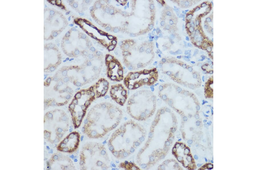 Immunohistochemistry - Anti-MTCO2 Antibody (A80659) - Antibodies.com