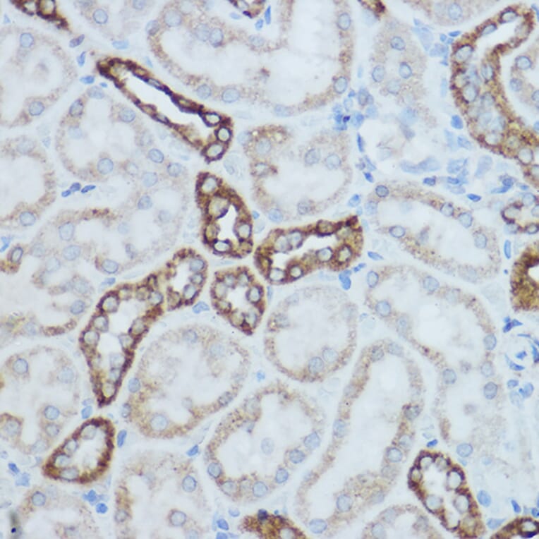 Immunohistochemistry - Anti-MTCO2 Antibody (A80659) - Antibodies.com