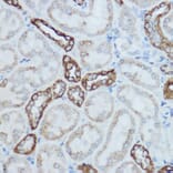 Immunohistochemistry - Anti-MTCO2 Antibody (A80659) - Antibodies.com