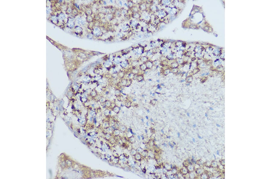 Immunohistochemistry - Anti-MTCO2 Antibody (A80659) - Antibodies.com