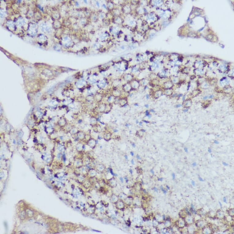 Immunohistochemistry - Anti-MTCO2 Antibody (A80659) - Antibodies.com