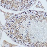 Immunohistochemistry - Anti-MTCO2 Antibody (A80659) - Antibodies.com