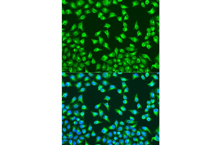 Immunofluorescence - Anti-MTCO2 Antibody (A80659) - Antibodies.com