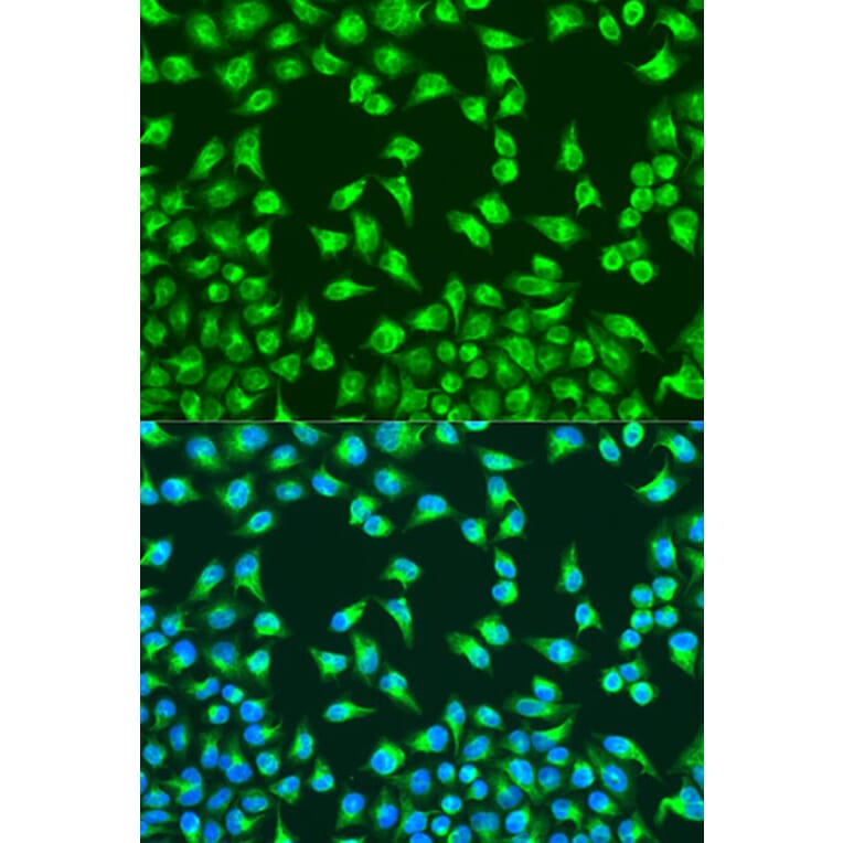 Immunofluorescence - Anti-MTCO2 Antibody (A80659) - Antibodies.com
