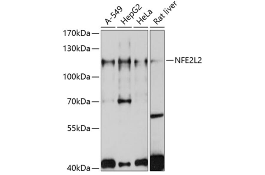 Western Blot - Anti-NFE2L2 Antibody (A11159) - Antibodies.com