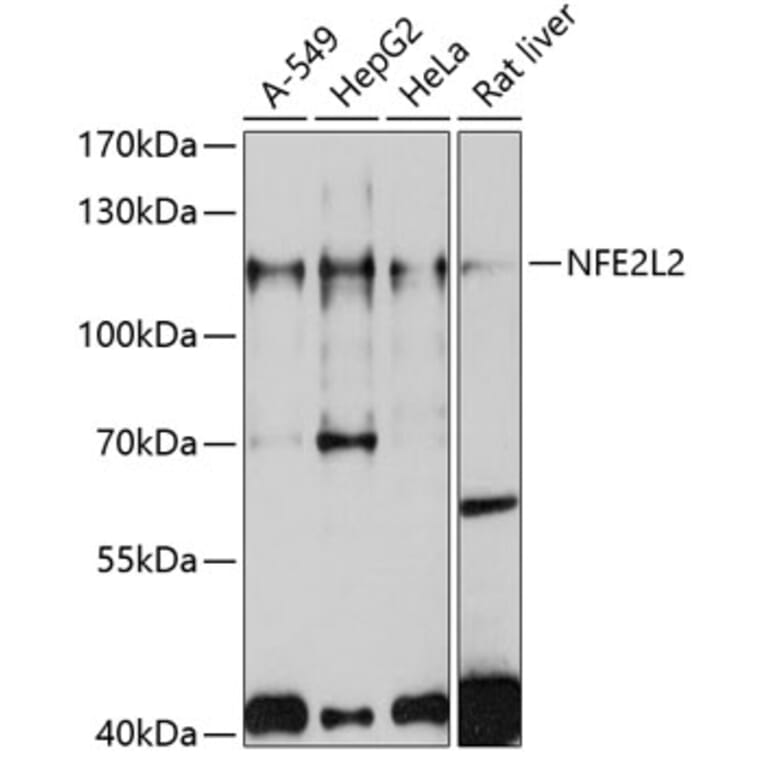 Western Blot - Anti-NFE2L2 Antibody (A11159) - Antibodies.com