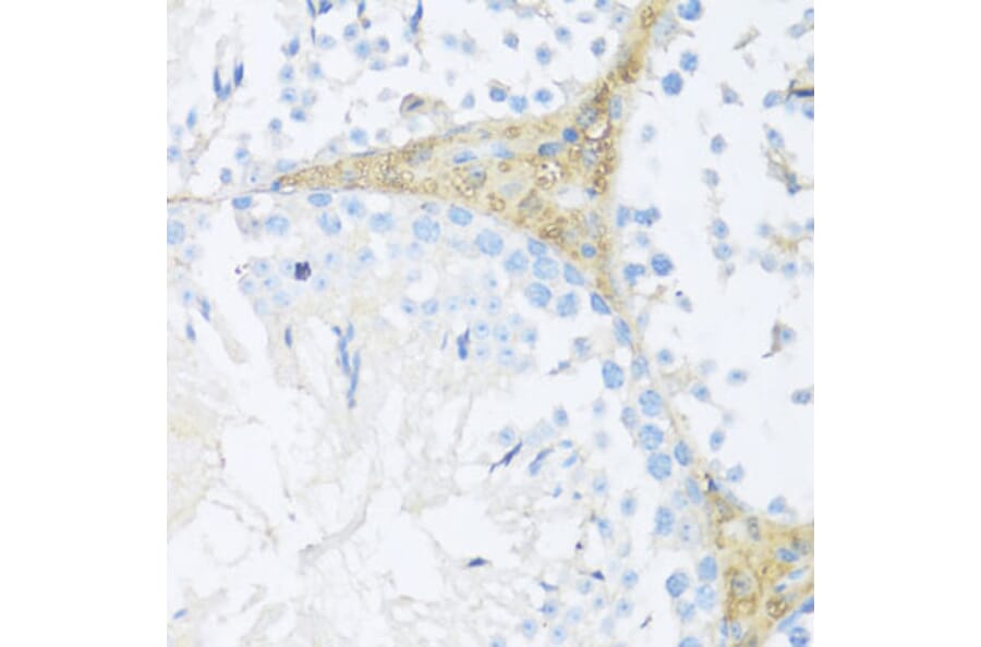 Immunohistochemistry - Anti-NFE2L2 Antibody (A11159) - Antibodies.com