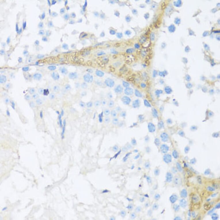 Immunohistochemistry - Anti-NFE2L2 Antibody (A11159) - Antibodies.com
