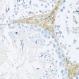 Immunohistochemistry - Anti-NFE2L2 Antibody (A11159) - Antibodies.com