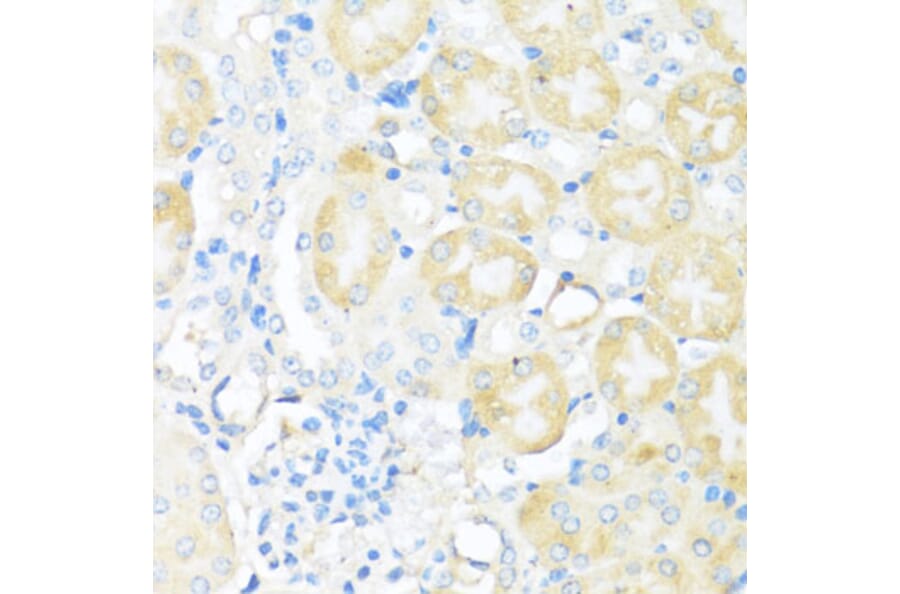 Immunohistochemistry - Anti-NFE2L2 Antibody (A11159) - Antibodies.com
