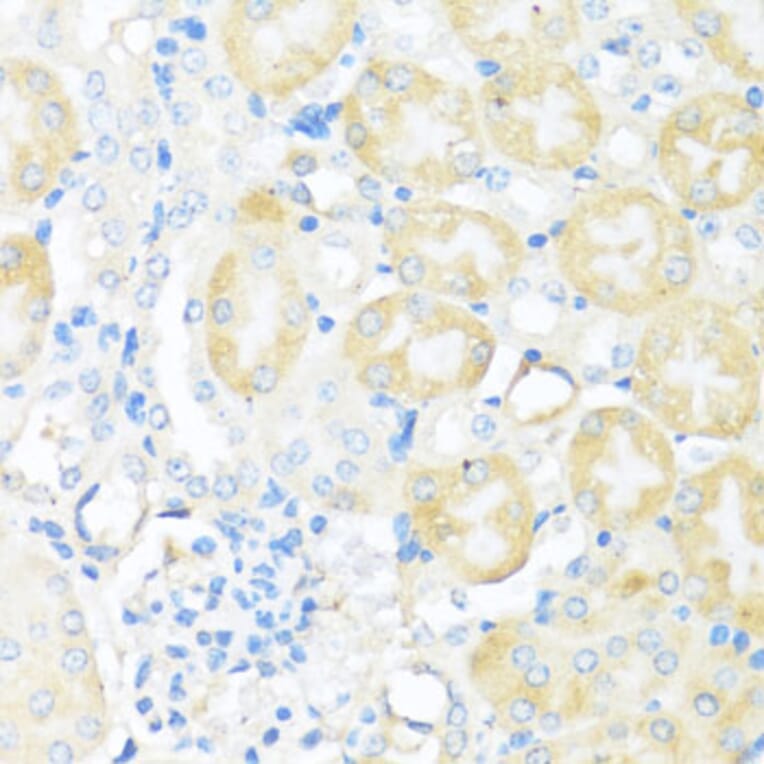 Immunohistochemistry - Anti-NFE2L2 Antibody (A11159) - Antibodies.com