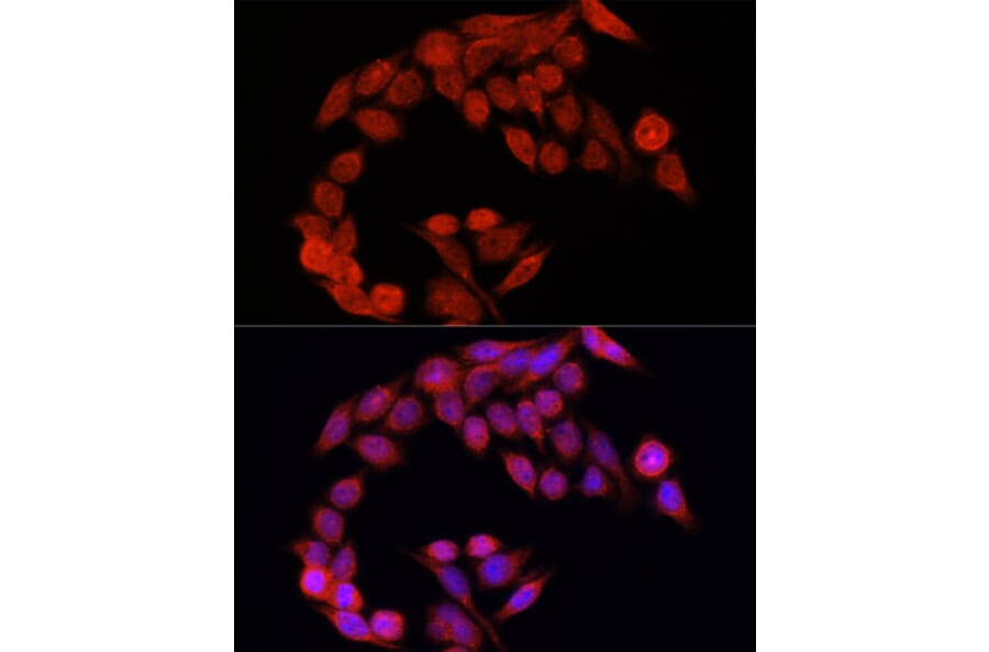 Immunofluorescence - Anti-NFE2L2 Antibody (A11159) - Antibodies.com