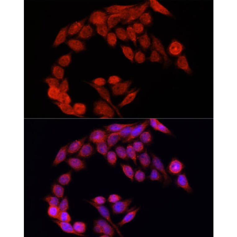 Immunofluorescence - Anti-NFE2L2 Antibody (A11159) - Antibodies.com