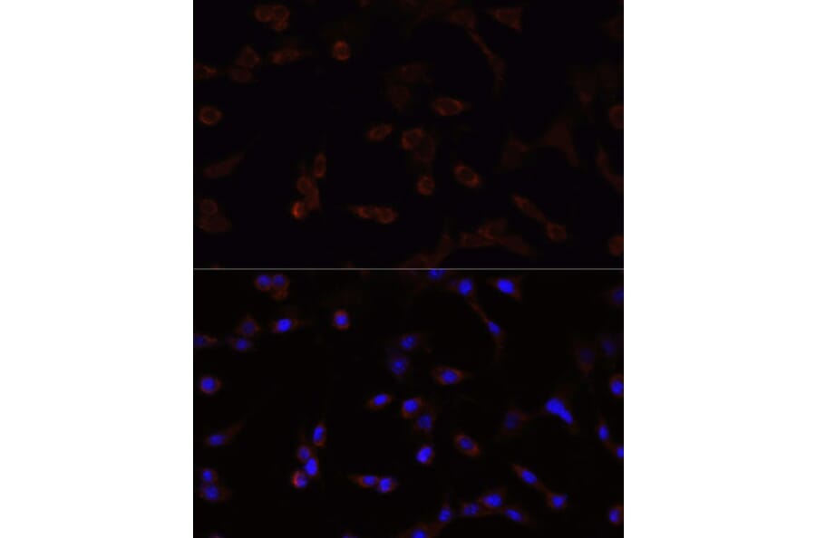 Immunofluorescence - Anti-NFE2L2 Antibody (A11159) - Antibodies.com