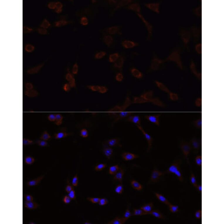 Immunofluorescence - Anti-NFE2L2 Antibody (A11159) - Antibodies.com