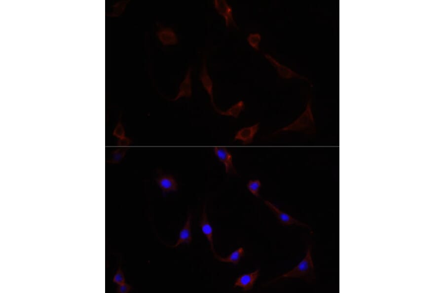 Immunofluorescence - Anti-NFE2L2 Antibody (A11159) - Antibodies.com