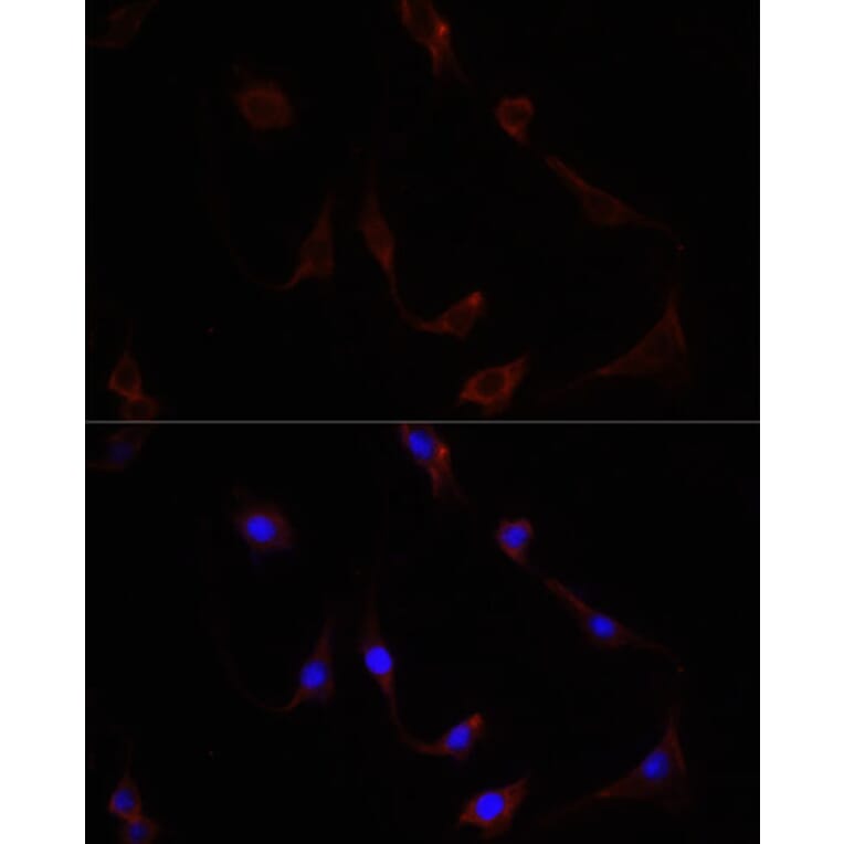 Immunofluorescence - Anti-NFE2L2 Antibody (A11159) - Antibodies.com