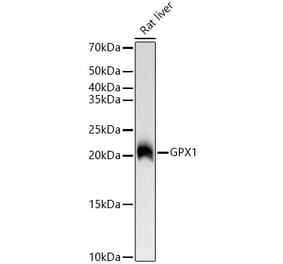 Western Blot - Anti-Glutathione Peroxidase 1 Antibody [ARC0536] (A80661) - Antibodies.com