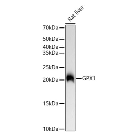 Western Blot - Anti-Glutathione Peroxidase 1 Antibody [ARC0536] (A80661) - Antibodies.com