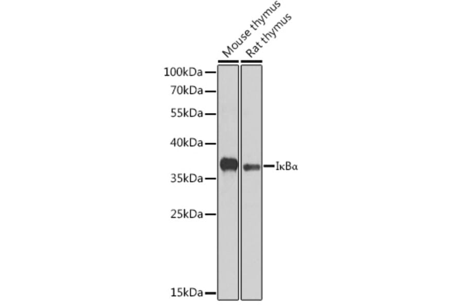 Western Blot - Anti-IKB alpha Antibody (A80662) - Antibodies.com
