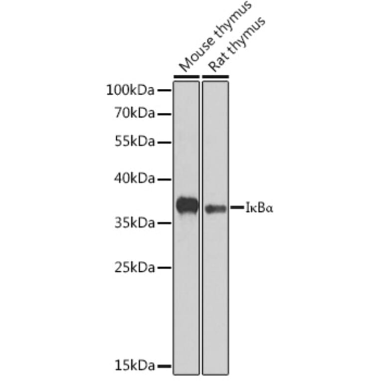Western Blot - Anti-IKB alpha Antibody (A80662) - Antibodies.com