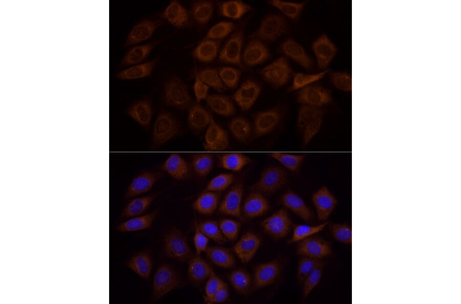 Immunofluorescence - Anti-PI 3 Kinase p85 alpha Antibody (A80663) - Antibodies.com