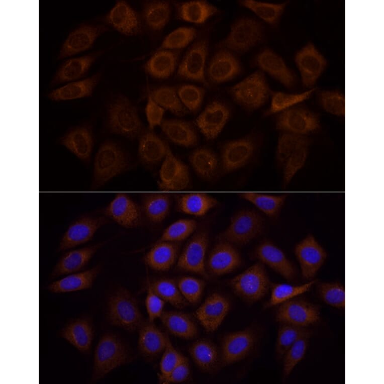 Immunofluorescence - Anti-PI 3 Kinase p85 alpha Antibody (A80663) - Antibodies.com