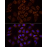 Immunofluorescence - Anti-PI 3 Kinase p85 alpha Antibody (A80663) - Antibodies.com
