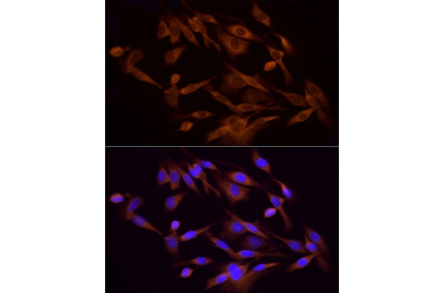 Immunofluorescence - Anti-PI 3 Kinase p85 alpha Antibody (A80663) - Antibodies.com